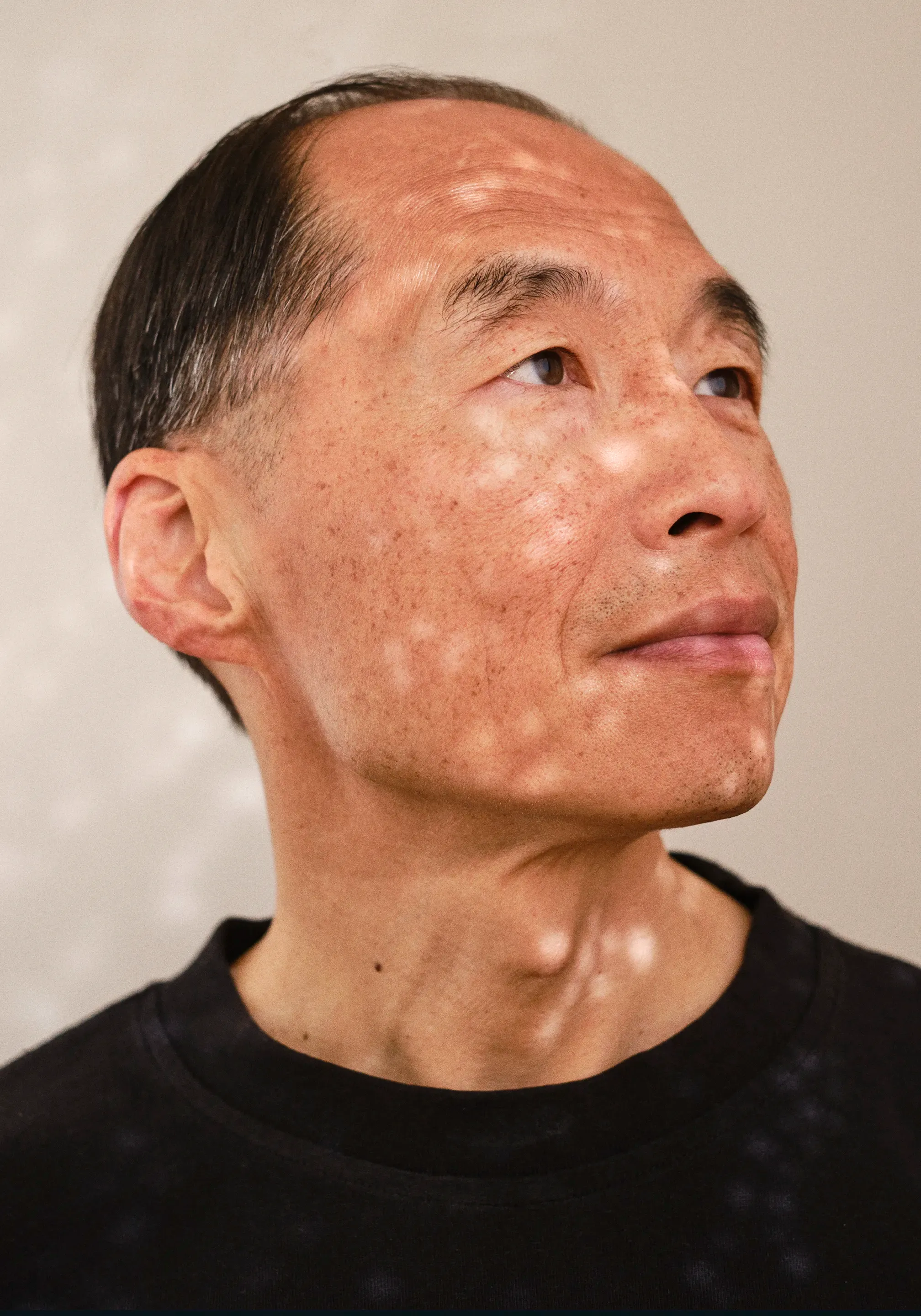 Olink campaign portrait: a man looking upward, dappled light across his face